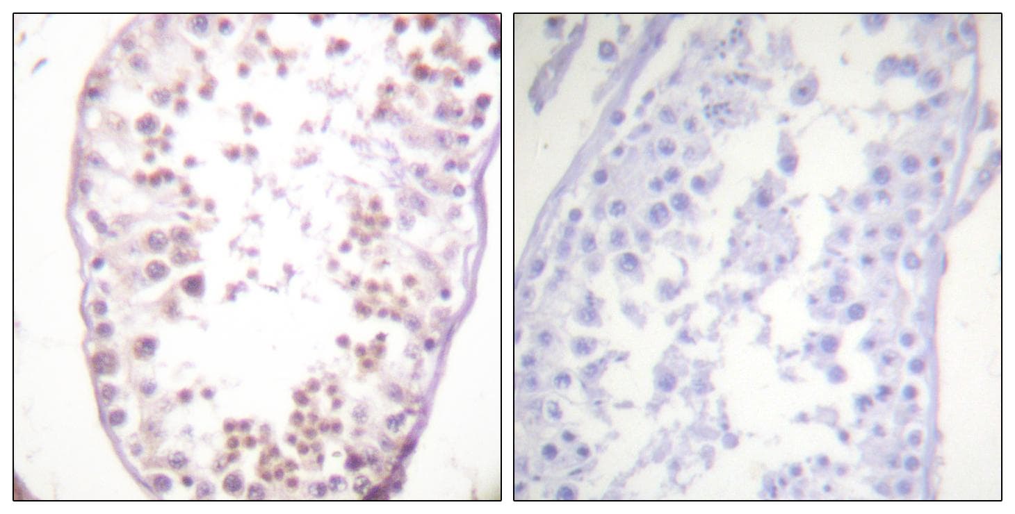 HDAC6 Antibody (phospho-Ser22)