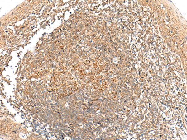 GRHPR / Glyoxylate Reductase Antibody