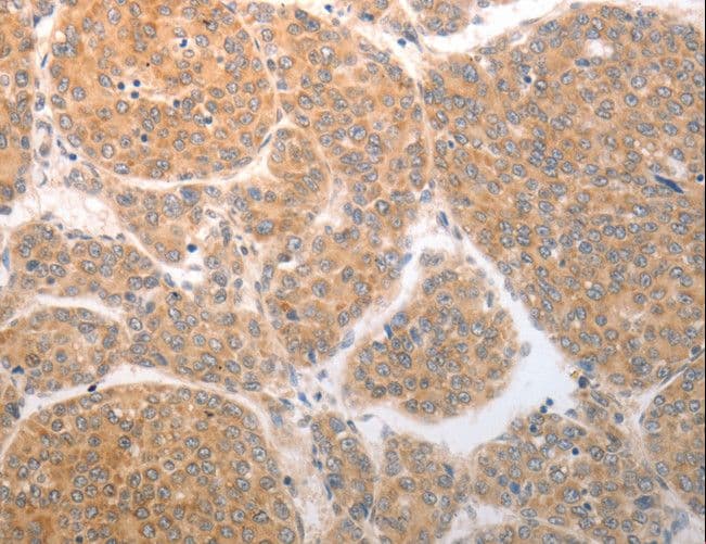 NQO1 Antibody