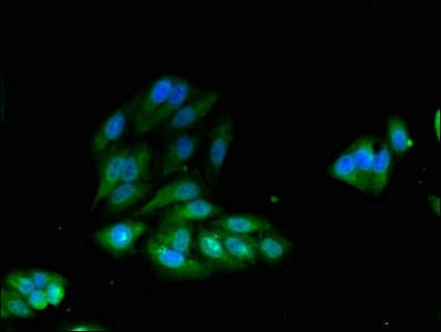 Polyclonal Rabbit anti-Human IRS2 / IRS-2 Antibody (IHC, IF)