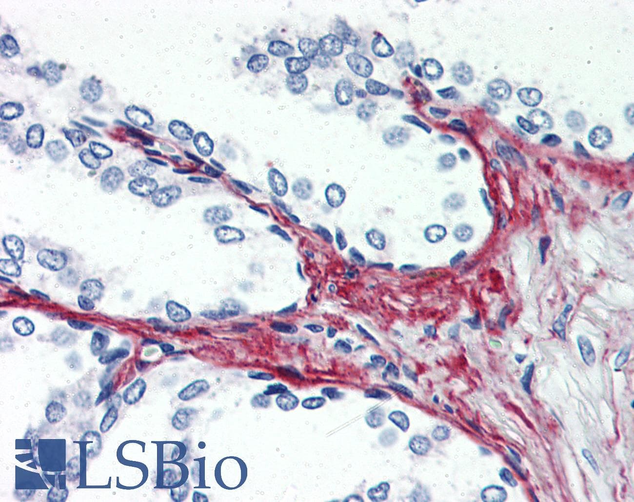 PathPlus™ P2RX3 / P2X3 Antibody (C-Terminus)