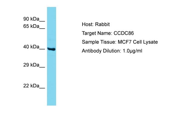 CCDC86 Antibody (aa101-150)