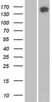 Human SBNO1 Protein (Over-Expression Lysate Myc-DDK (Flag))