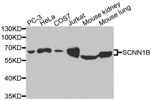SCNN1B / ENaC Beta Antibody
