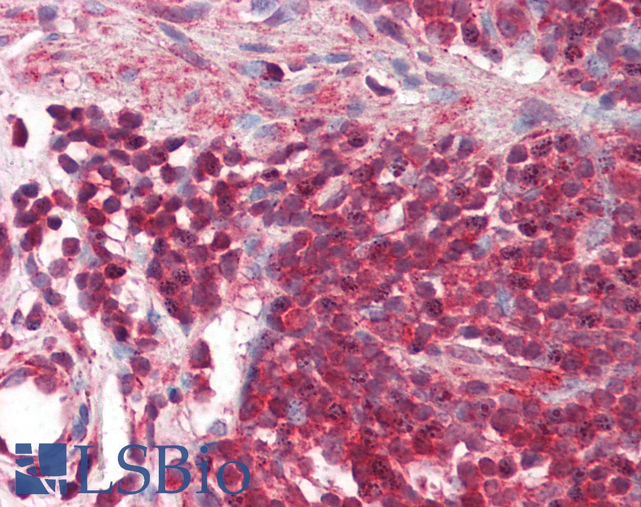 IHC-plus™ Polyclonal Rabbit anti-Human REL / C-Rel Antibody (IHC, WB)