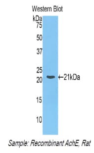 ACHE / Acetylcholinesterase Antibody (aa157-332)