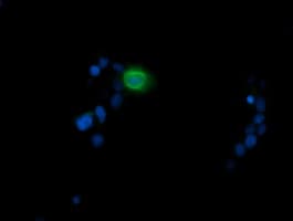 IHC-plus™ MDM4 / MDMX Antibody (clone 4G5)
