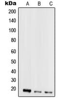 IHC-plus™ Polyclonal Rabbit anti-Human SCGB2A2 / Mammaglobin A Antibody (Internal, IHC, IF, WB)