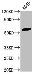 IHC-plus™ IFIT3 Antibody (aa1-490)