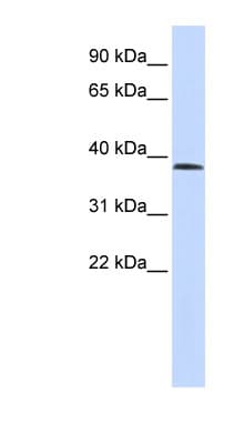 Polyclonal Rabbit anti-Human SUV420H1 Antibody (C-Terminus, WB)