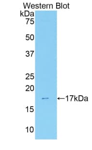 ANXA3 / Annexin A3 Antibody (aa184-318)