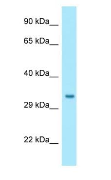 NIPSNAP1 Antibody (aa187-236)