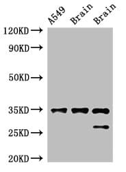 Polyclonal Rabbit anti-Human STUB1 / CHIP Antibody (IHC, IF, WB)