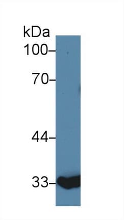 ANXA4 / Annexin IV Antibody (aa2-166)