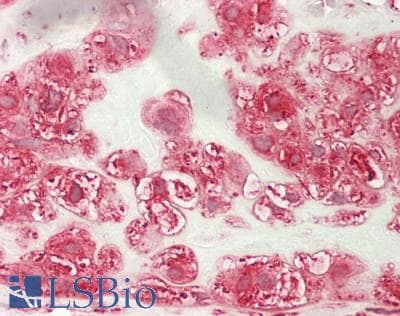 IHC-plus™ Polyclonal Rabbit anti-Human ARF4 Antibody (aa2-180, IHC, WB)
