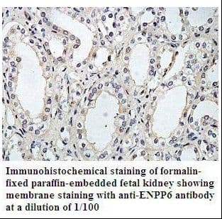ENPP6 Antibody (aa25-195)