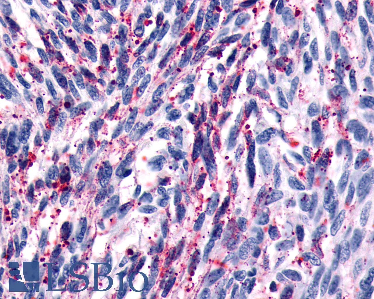 PathPlus™ Polyclonal Rabbit anti-Human GPR161 Antibody (C-Terminus, IHC)
