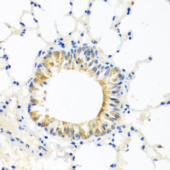Polyclonal Rabbit anti-Human COQ7 Antibody (IHC, WB)