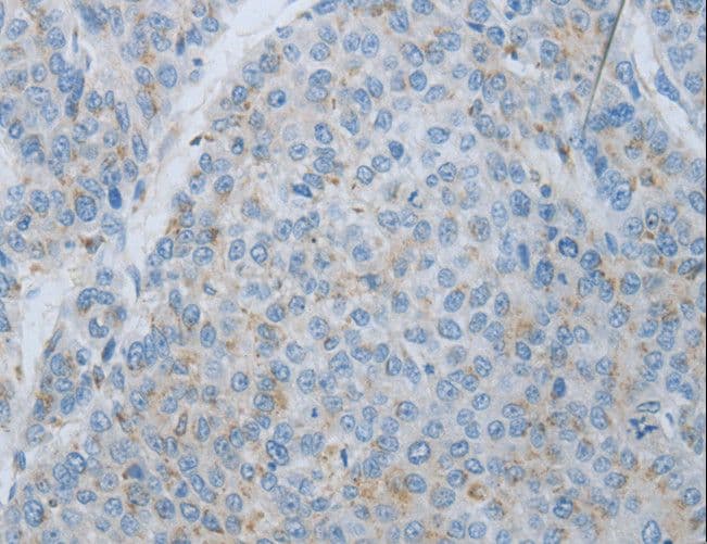 MMP25 / Leukolysin Antibody