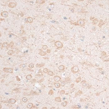 HMGIY / HMGA1 Antibody