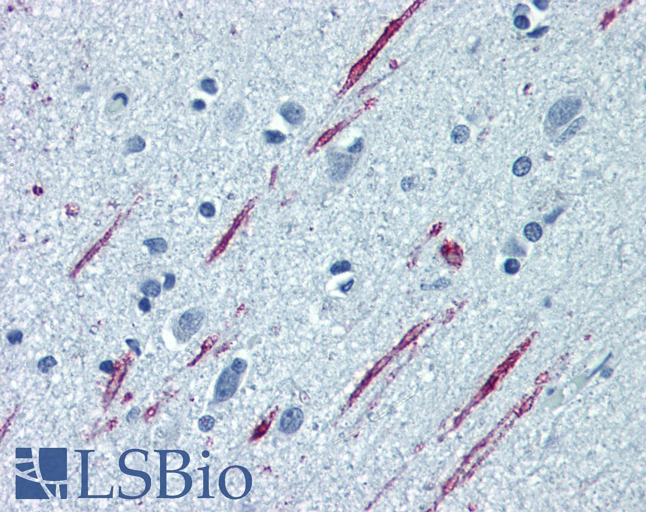 IHC-plus™ Spastin Antibody (clone 2F5)