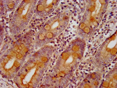SLC26A6 / PAT1 Antibody