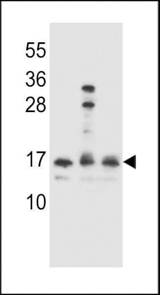 IHC-plus™ Polyclonal Rabbit anti-Human HOPX / HOP Antibody (aa39-67, IHC, WB)
