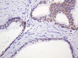 CTNND1 / p120 Catenin Antibody (clone OTI2E8)