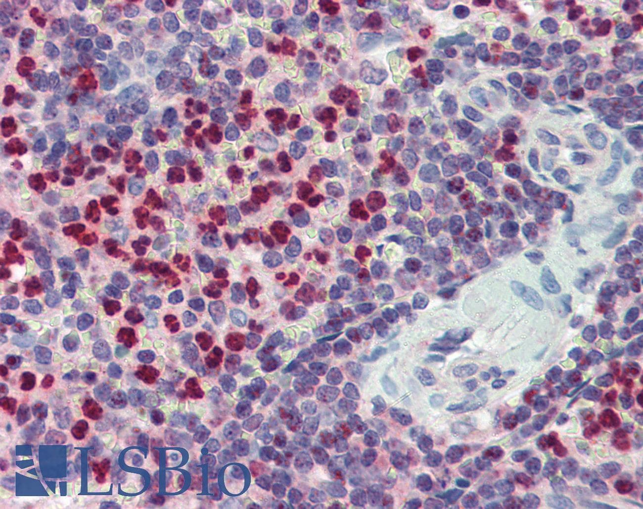 FCHO1 Antibody (aa468-517)