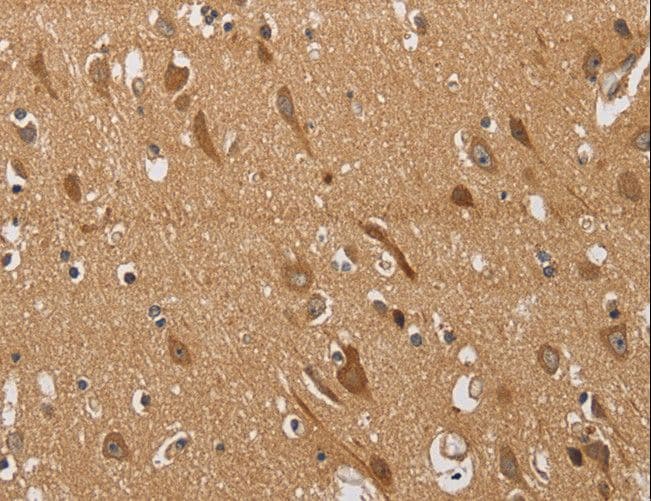 Polyclonal Rabbit anti-Human KCNQ4 Antibody (IHC, WB)