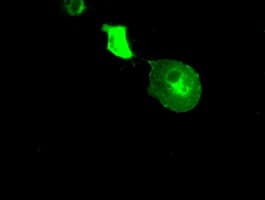 Monoclonal Mouse anti-Human CRYAB / Alpha B Crystallin Antibody (clone OTI2A1, IHC, IF, WB)