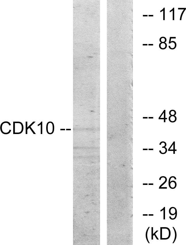 CDK10 Antibody