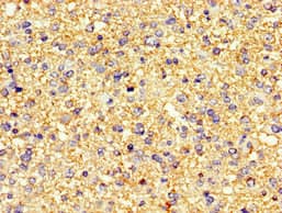 PDE4B Antibody