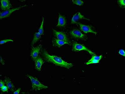 KCNMA1 / BK Antibody