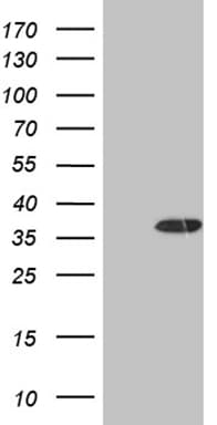 DECR1 Antibody (clone OTI5D6)