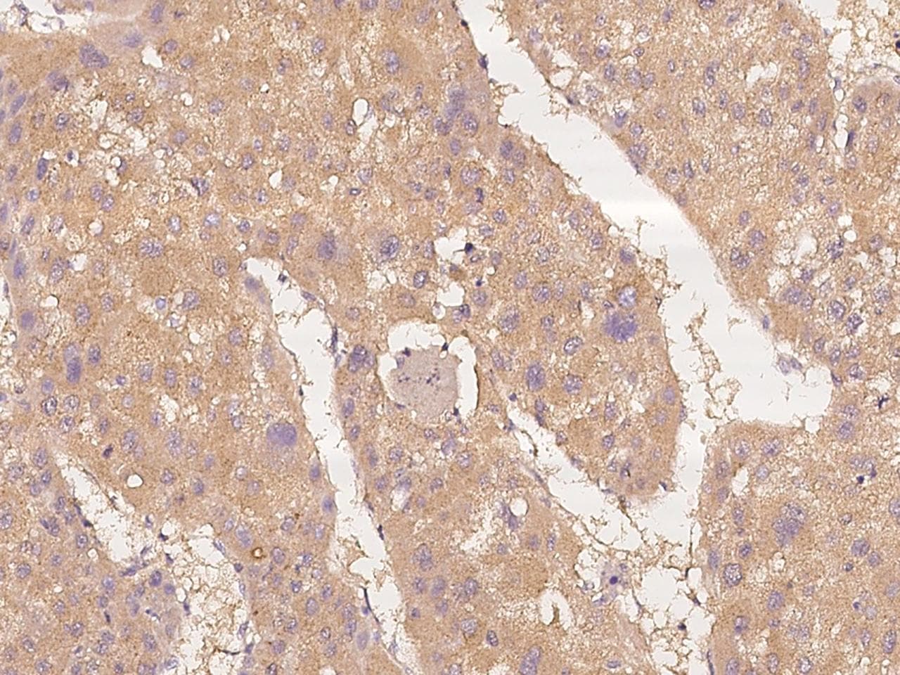 DGK-IOTA / DGKI Antibody
