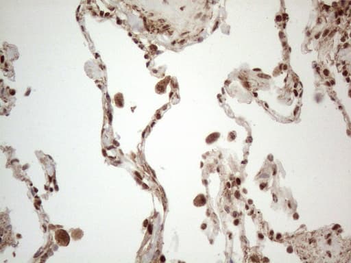IRS1 Antibody (aa1-280, clone OTI3G10, Carrier-free)