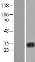 CA2 / Carbonic Anhydrase II Protein (Over-Expression Lysate Myc-DDK (Flag))