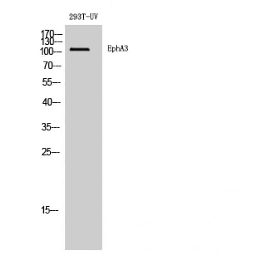 EPHA3 / EPH Receptor A3 Antibody (800-880 aa, C-terminal)