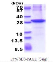 Human CLMP / ACAM Protein (Recombinant His)