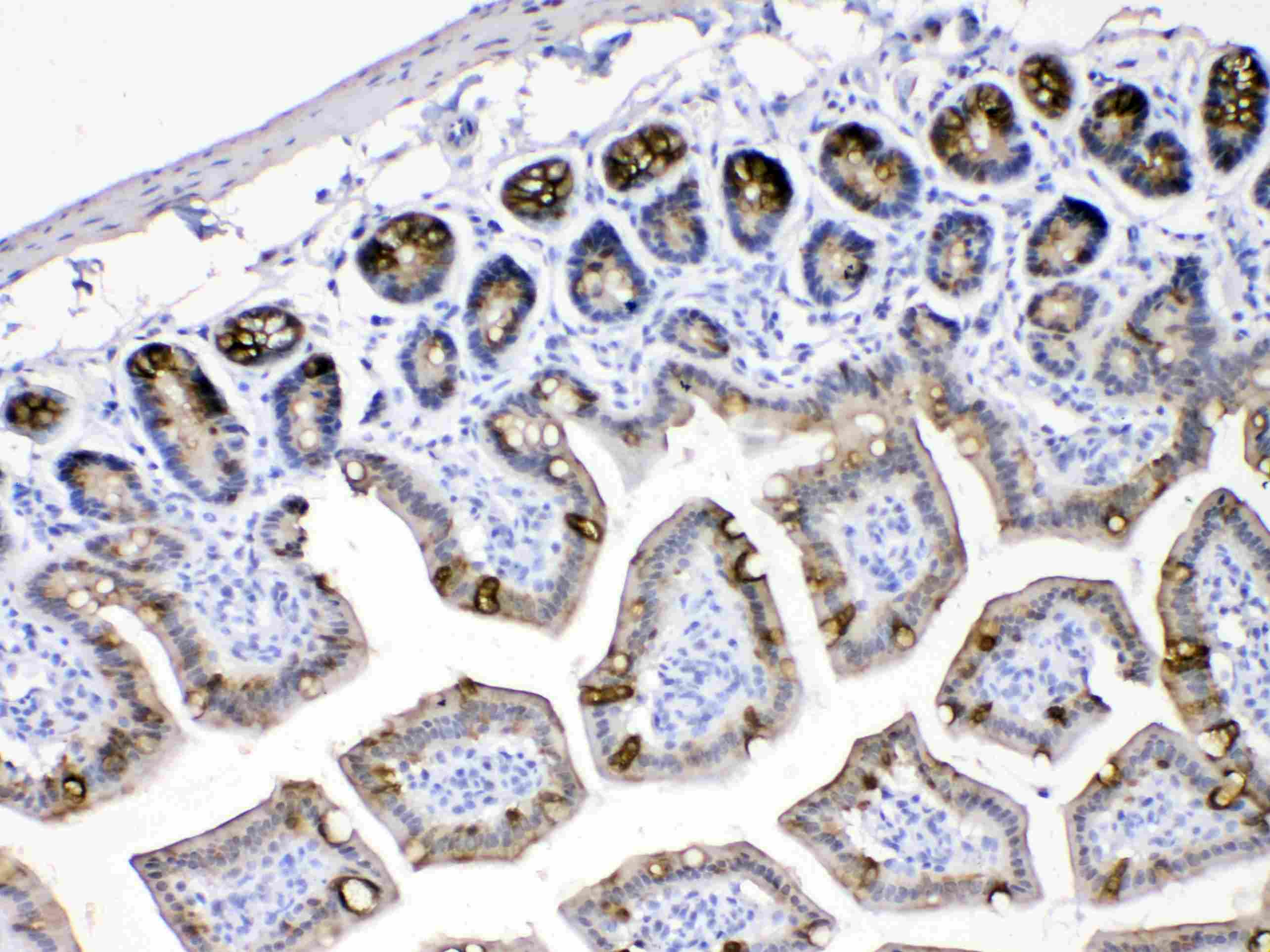 KRT18 / CK18 / Cytokeratin 18 Antibody
