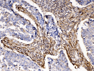 Polyclonal Rabbit anti-Human ACTN3 Antibody (IHC, WB)