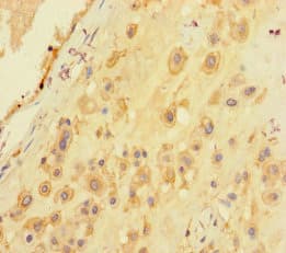 SARS / Serine-tRNA Ligase Antibody