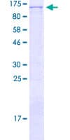 Human NBN / Nibrin Protein (Recombinant GST)