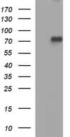 TP73 / p73 Antibody (aa167-409, clone OTI3C5)