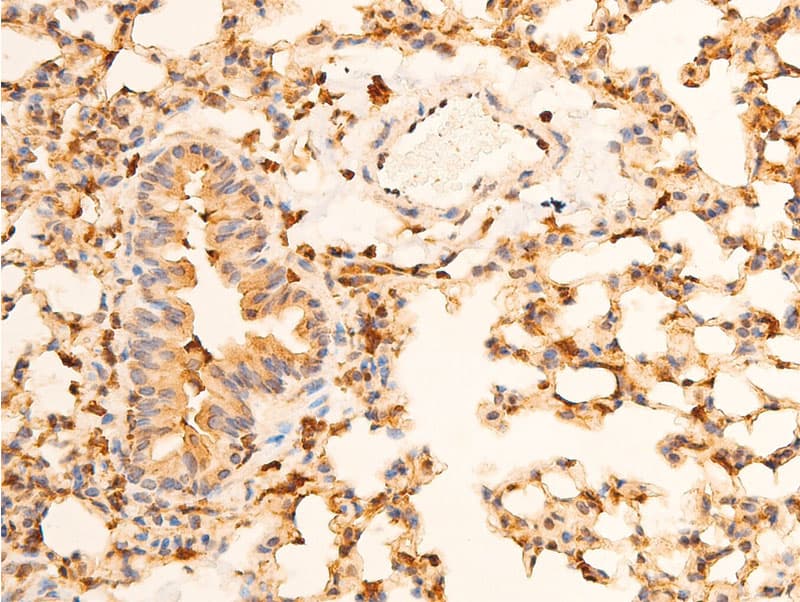 Polyclonal Rabbit anti-Human NFKBIA / IKB Alpha / IKBA Antibody (phospho-Ser32,phospho-Ser36, IHC, IF, WB)