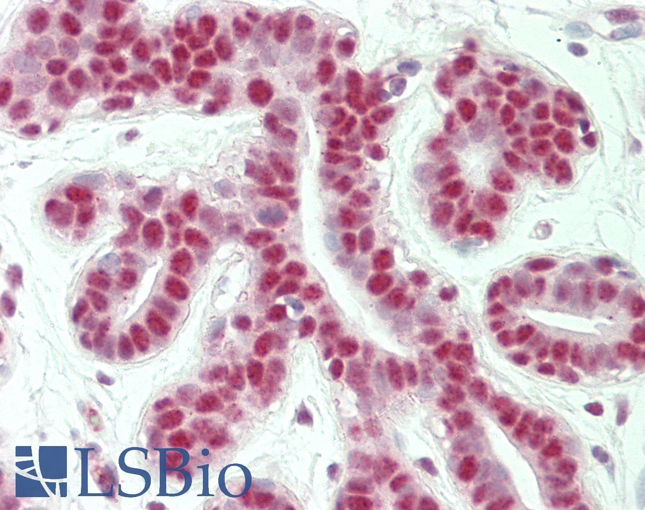 IHC-plus™ Polyclonal Rabbit anti-Human GTF2I / TFII I Antibody (aa956-985, IHC, IF, WB)