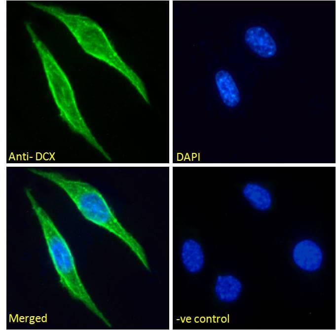 Polyclonal Goat anti-Mouse DCX / Doublecortin Antibody (Internal Region, IF, WB)