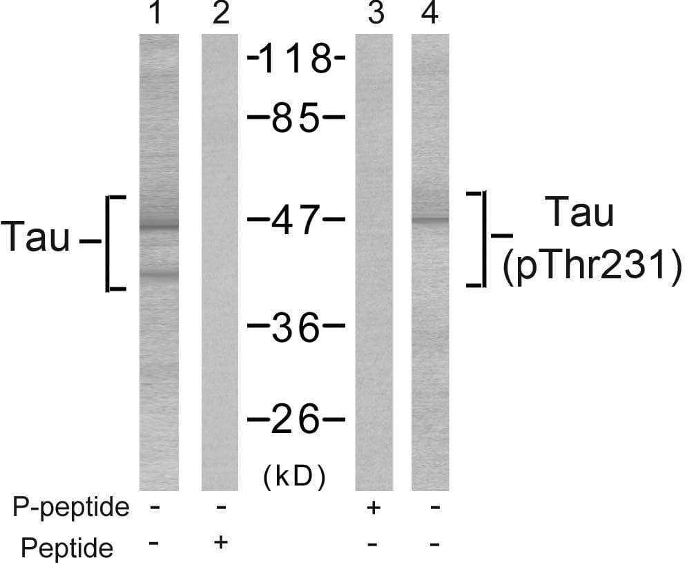 MAPT / Tau Antibody (phospho-Thr231)