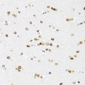 Polyclonal Rabbit anti-Human DDX21 Antibody (IHC, IF)
